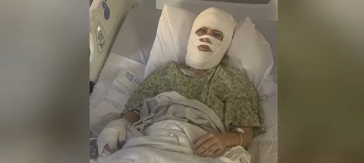 Patient recovering in a hospital bed with facial bandages and medical attire, indicating post-surgery care.