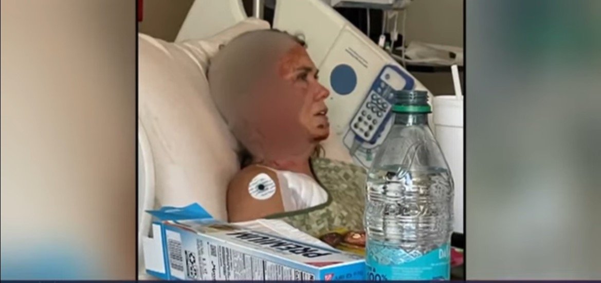 Hospitalized woman in bed with medical equipment and water bottle nearby, showing signs of recovery and care.