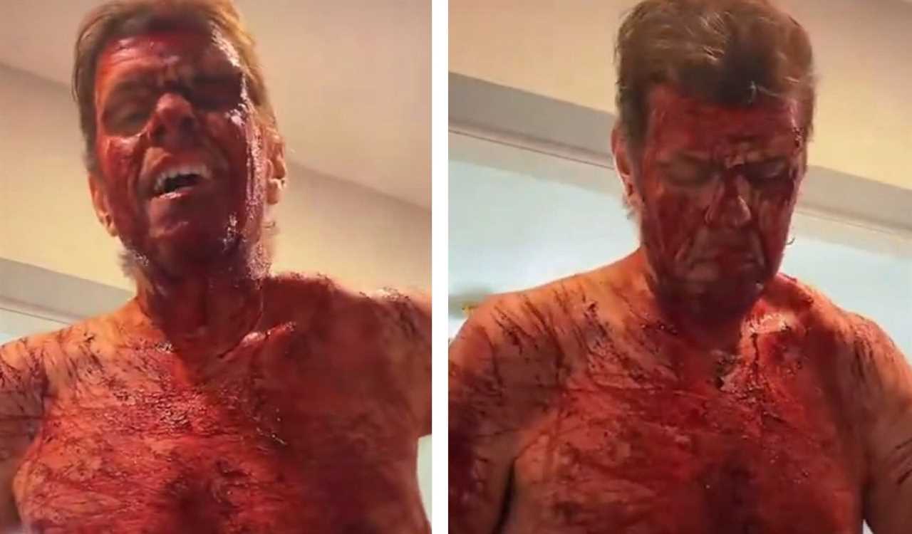 Celebrity Blogger Perez Hilton Still Hospitalized After Cutting Himself on TikTok Live, Will Need Surgery